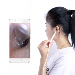 WiFi Digital Otoscope